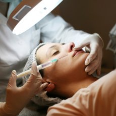 Lip fillers / Upper Eye Lift Surgery