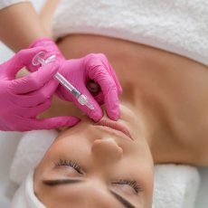 Lip Fillers Birmingham