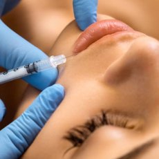 Injection de toxine botulique