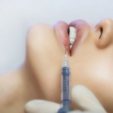 Botox Anti-Wrinkle Injections