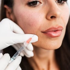 Restylane Skin Boosters