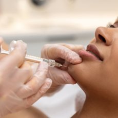 Les injections de Botox