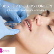 Botox Treatment and Injections London