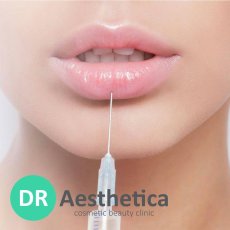 Dermal Fillers